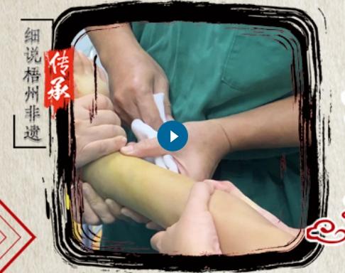 妙手正骨法 仁術遠流長